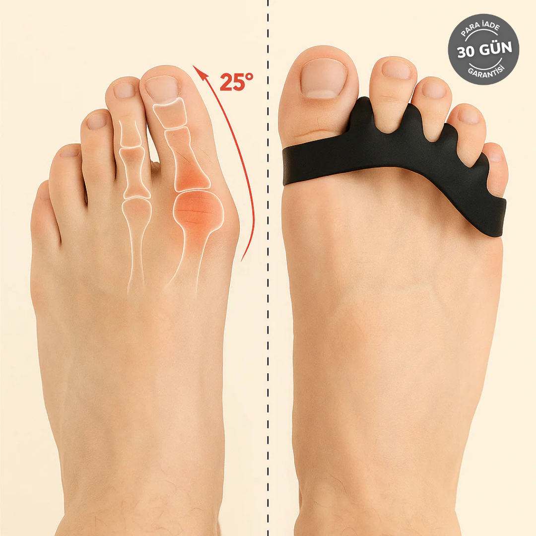 LooFeet - Ayak Parmak Ayırıcı & Düzeltici